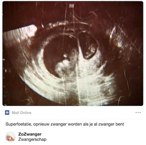 Superfoetatie zwanger worden als je zwanger bent