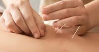 acupunctuur bij vruchtbaarheidsproblemen gilles stoop acupuncturist