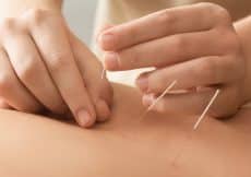 acupunctuur bij vruchtbaarheidsproblemen gilles stoop acupuncturist