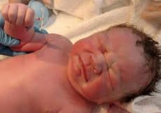 baby mirena spiraal hand geboorte