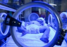 behandeling geelzucht pasgeborenen