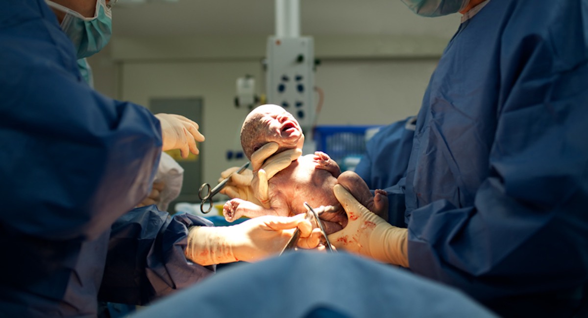 complicatie bij de baby bevalling