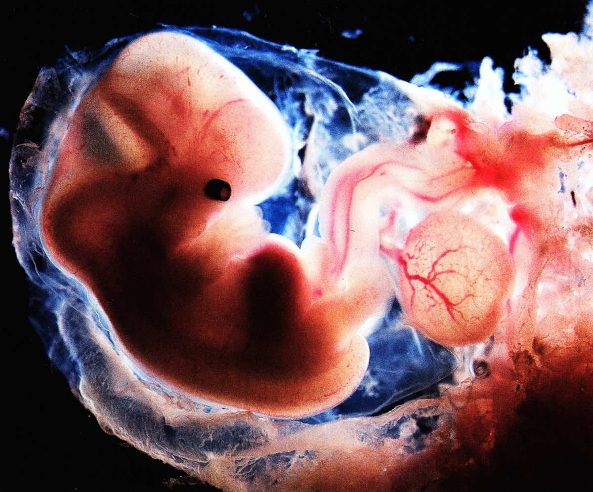 embryo 6 weken miskraam