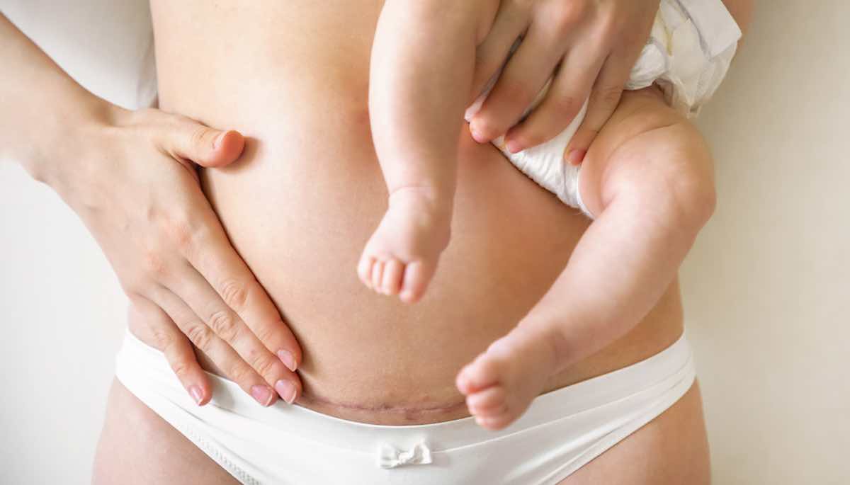 herstel na bevalling tips