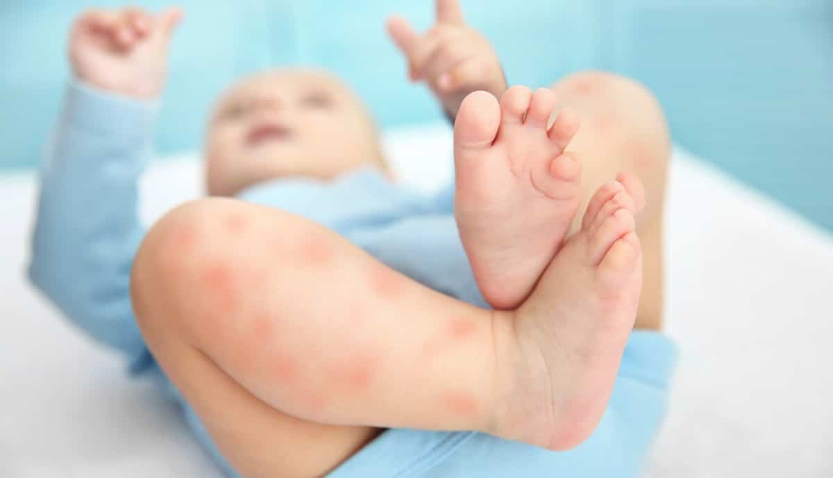 hoe baby beschermen tegen muggen