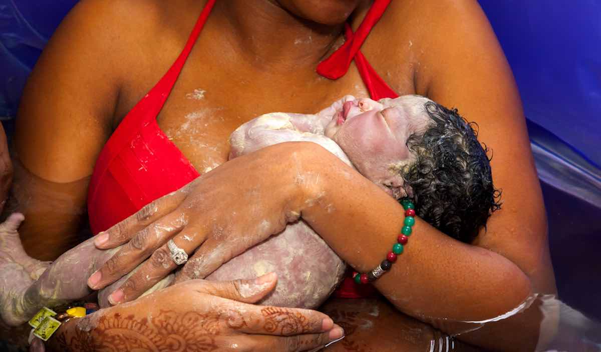 huidsmeer bij pasgeboren baby