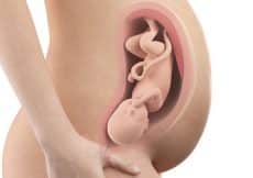indalen van de baby zwangerschap