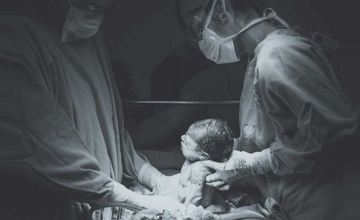 Medisch ingrijpen bij de bevalling