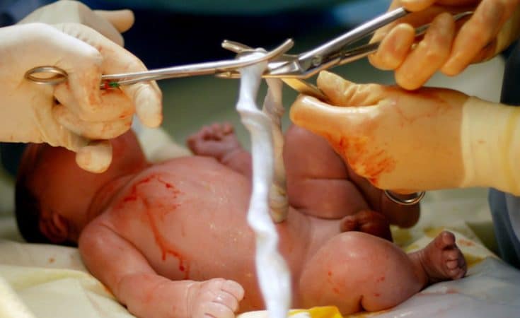 stamcellen opslaan uit navelstreng baby