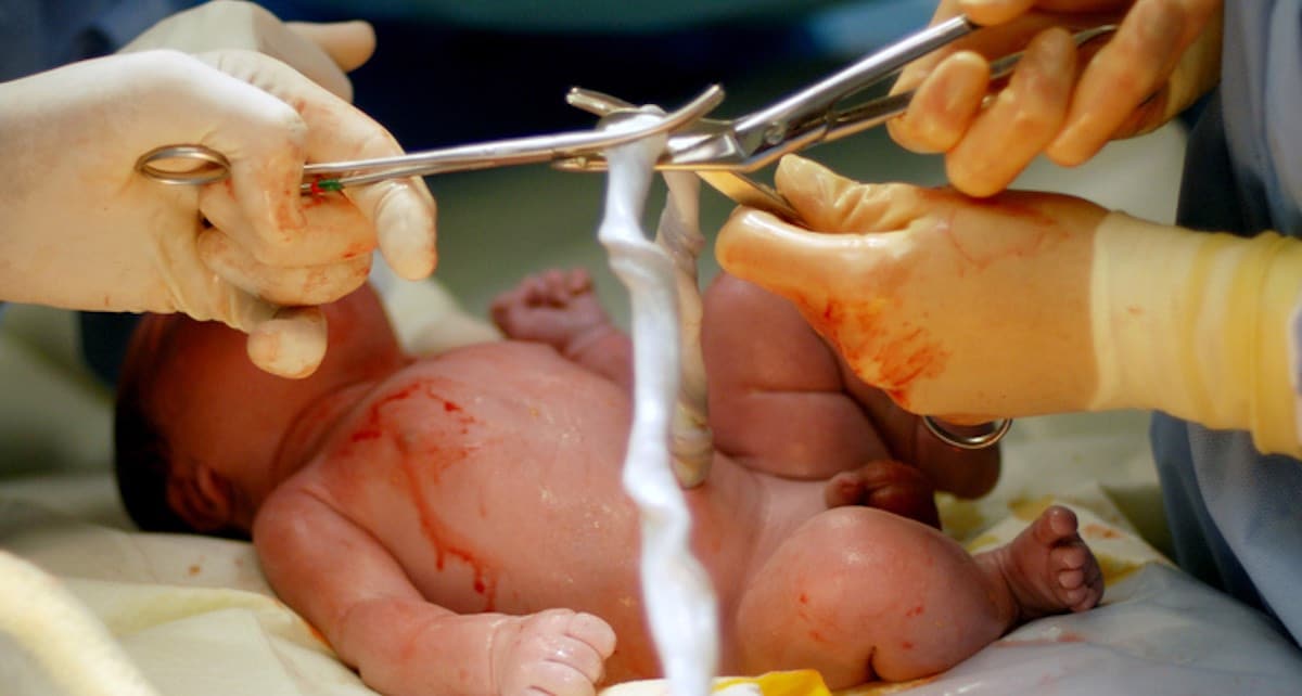 stamcellen opslaan uit navelstreng baby