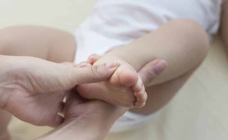 wat is klompvoet bij een baby